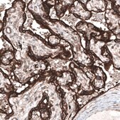 Monoclonal Anti-CLIP1 antibody produced in mouse Prestige Antibodies® Powered by Atlas Antibodies, clone CL4851, purified immunoglobulin, buffered aqueous glycerol solution
