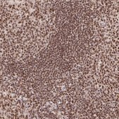 Anti-USF1 antibody produced in rabbit Prestige Antibodies® Powered by Atlas Antibodies, affinity isolated antibody, buffered aqueous glycerol solution