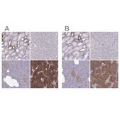 Anti-CASR antibody produced in rabbit Prestige Antibodies® Powered by Atlas Antibodies, affinity isolated antibody, buffered aqueous glycerol solution