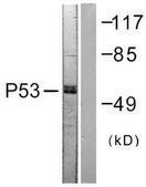Anti-p53, antibody produced in rabbit affinity isolated antibody