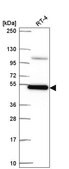 Anti-SMAD3 antibody produced in rabbit Prestige Antibodies® Powered by Atlas Antibodies, affinity isolated antibody