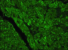 Anti-Vinculin antibody produced in rabbit affinity isolated antibody, buffered aqueous solution