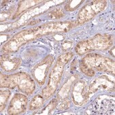 Anti-MICU2 antibody produced in rabbit Prestige Antibodies® Powered by Atlas Antibodies, affinity isolated antibody, buffered aqueous glycerol solution