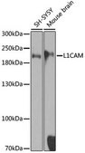 Anti-L1CAM antibody produced in rabbit