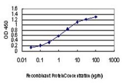 Monoclonal Anti-PAK1 antibody produced in mouse clone 1E11, purified immunoglobulin, buffered aqueous solution