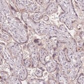 Anti-STK39 antibody produced in rabbit Prestige Antibodies® Powered by Atlas Antibodies, affinity isolated antibody, buffered aqueous glycerol solution