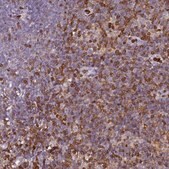 Anti-S100A4 antibody produced in rabbit Prestige Antibodies® Powered by Atlas Antibodies, affinity isolated antibody, buffered aqueous glycerol solution