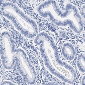 Anti-AKAP4 antibody produced in rabbit Prestige Antibodies® Powered by Atlas Antibodies, affinity isolated antibody, buffered aqueous glycerol solution