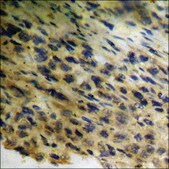 Anti-phospho-HER3 (pTyr1289) antibody produced in rabbit affinity isolated antibody
