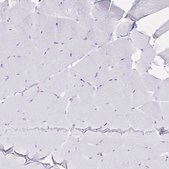 Anti-IL2RB antibody produced in rabbit Prestige Antibodies® Powered by Atlas Antibodies, affinity isolated antibody, buffered aqueous glycerol solution