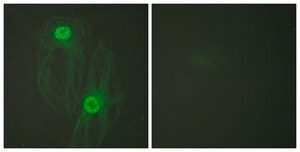 Anti-KIF11 antibody produced in rabbit affinity isolated antibody