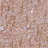 Anti-SIRT2 antibody produced in rabbit Prestige Antibodies® Powered by Atlas Antibodies, affinity isolated antibody, buffered aqueous glycerol solution