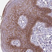 Anti-DSC3 antibody produced in rabbit Prestige Antibodies® Powered by Atlas Antibodies, affinity isolated antibody, buffered aqueous glycerol solution