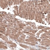 Monoclonal Anti-LAPTM4B antibody produced in mouse Prestige Antibodies® Powered by Atlas Antibodies, clone CL5287, purified immunoglobulin, buffered aqueous glycerol solution