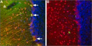 Anti-TRPC3 antibody produced in rabbit affinity isolated antibody, lyophilized powder