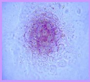 ES 细胞鉴定试剂盒 The Embryonic Stem Cell Characterization Kit phenotypically assesses the differentiation status of ES cells by measuring their AP activity, cell-surface stage-specific antigens (SSEA-1, SSEA-4) as well as expression of TRA-1-60, TRA-1-81 antigens.