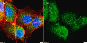 Anti-MLC-2 Antibody, clone 1B16 ZooMAb® Rabbit Monoclonal recombinant, expressed in HEK 293 cells