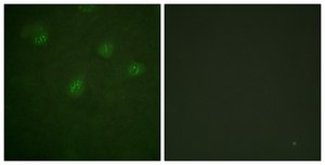 Anti-Estrogen Receptor-α, C-Terminal antibody produced in rabbit affinity isolated antibody
