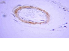 Anti-Beta-Amyloid 1-42 Antibody Chemicon®, from rabbit