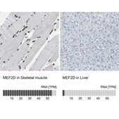Anti-MEF2D antibody produced in rabbit Ab2, Prestige Antibodies® Powered by Atlas Antibodies, affinity isolated antibody, buffered aqueous glycerol solution
