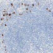 Anti-IL6ST antibody produced in rabbit Prestige Antibodies® Powered by Atlas Antibodies, affinity isolated antibody, buffered aqueous glycerol solution