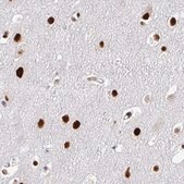 Monoclonal Anti-ADAR antibody produced in mouse Prestige Antibodies® Powered by Atlas Antibodies, clone CL0176, purified immunoglobulin, buffered aqueous glycerol solution