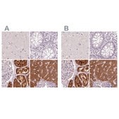 Anti-FTCD antibody produced in rabbit Prestige Antibodies® Powered by Atlas Antibodies, affinity isolated antibody, buffered aqueous glycerol solution