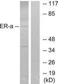 Anti-Estrogen Receptor-α antibody produced in rabbit affinity isolated antibody