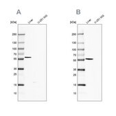 Anti-FTCD antibody produced in rabbit Prestige Antibodies® Powered by Atlas Antibodies, affinity isolated antibody, buffered aqueous glycerol solution