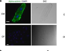 单克隆抗 α-辅肌动蛋白 小鼠抗 clone BM-75.2, ascites fluid