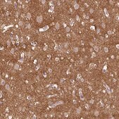Anti-PRKAA2 antibody produced in rabbit Prestige Antibodies® Powered by Atlas Antibodies, affinity isolated antibody, buffered aqueous glycerol solution