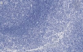 Anti-Clusterin Antibody, clone 2F23 ZooMAb® Rabbit Monoclonal recombinant, expressed in HEK 293 cells