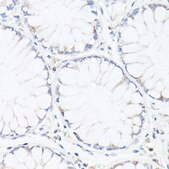 Anti-p53 antibody produced in rabbit