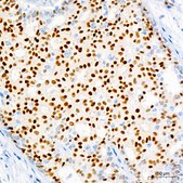 Anti-Progesterone Receptor Antibody, clone 4Y4H5, Rabbit Monoclonal