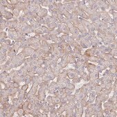 Anti-ITGA2 antibody produced in rabbit Prestige Antibodies® Powered by Atlas Antibodies, affinity isolated antibody, buffered aqueous glycerol solution