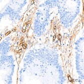Anti-Integrin alpha 5 (ITGA5/CD49e) Antibody, clone 8F2O6, Rabbit Monoclonal