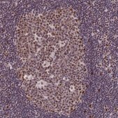 Anti-DIS3 antibody produced in rabbit affinity isolated antibody, buffered aqueous glycerol solution