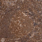 Anti-PFDN4 antibody produced in rabbit Prestige Antibodies® Powered by Atlas Antibodies, affinity isolated antibody, buffered aqueous glycerol solution