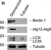 抗-α微管蛋白抗体，小鼠单克隆抗体 clone B-5-1-2, purified from hybridoma cell culture