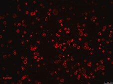 CR4 Human Colorectal Cancer Cell Line CR4 is a unique, cancer stem cell (CSC) enriched, human colorectal cancer cell line useful for CSC-targeted drug development and research focused on cancer cell and CSC biology.