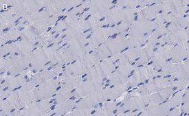 Anti-Dystrophin Antibody, clone 1G7, ZooMAb® Rabbit Monoclonal recombinant, expressed in HEK 293 cells