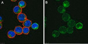Anti-IL-6 Antibody, clone 3B9 ZooMAb® Rabbit Monoclonal recombinant, expressed in HEK 293 cells