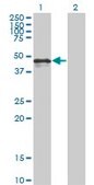 Monoclonal Anti-CALR antibody produced in mouse clone 1G11-1A9, purified immunoglobulin, buffered aqueous solution
