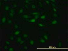 ANTI-STAT5B antibody produced in mouse clone 2D1, purified immunoglobulin, buffered aqueous solution