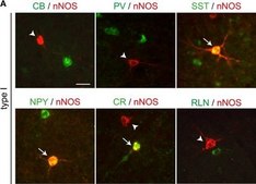 抗小清蛋白抗体 ascites fluid, clone PARV-19, Chemicon®