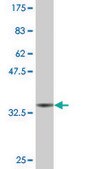 Monoclonal Anti-WT1 antibody produced in mouse clone 1E9, purified immunoglobulin, buffered aqueous solution