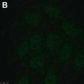 Anti-phospho-Chk1(Ser345) Antibody, clone 3D14 ZooMAb® Rabbit Monoclonal recombinant, expressed in HEK 293 cells