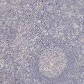 Anti-DMD antibody produced in rabbit Prestige Antibodies® Powered by Atlas Antibodies, affinity isolated antibody, buffered aqueous glycerol solution