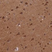 Anti-BICD1 antibody produced in rabbit Prestige Antibodies® Powered by Atlas Antibodies, affinity isolated antibody, buffered aqueous glycerol solution