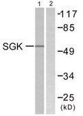 Anti-SGK antibody produced in rabbit affinity isolated antibody